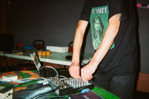 Epilepsy at Turn! Turn! Turn! - December 16 2025