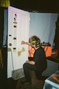 Epilepsy at Turn! Turn! Turn! - December 16 2025