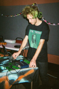 Epilepsy at Turn! Turn! Turn! - December 16 2025